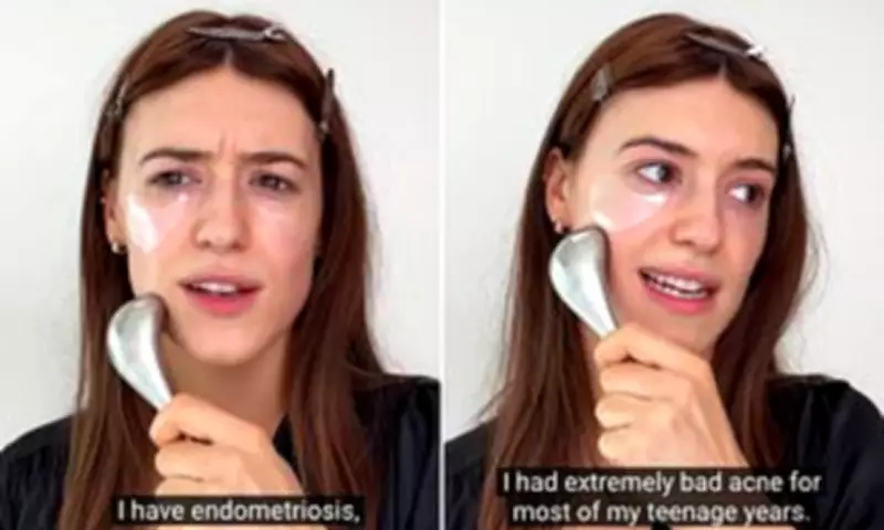 Daisy Edgar-Jones Reveals Endometriosis Battle and Management Journey