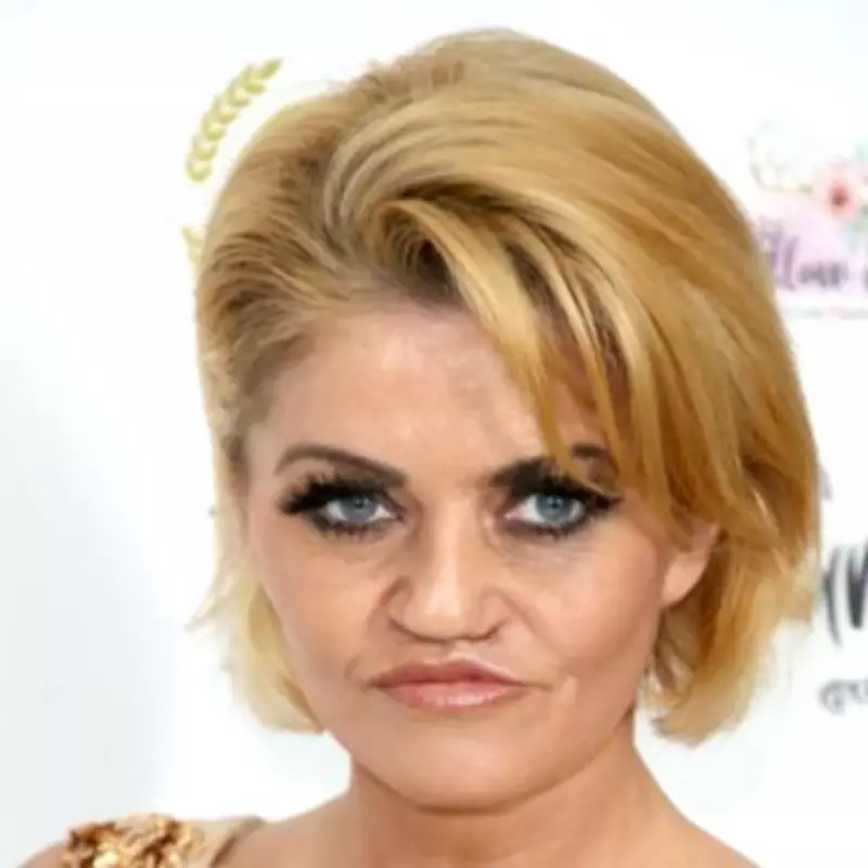 Danniella Westbrook 'Terrified' of Future Surgeries After Painful Facial Reconstruction