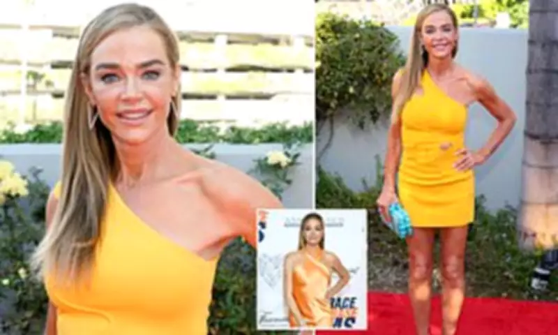 Denise Richards Reveals Full Facelift Journey in Candid Interview