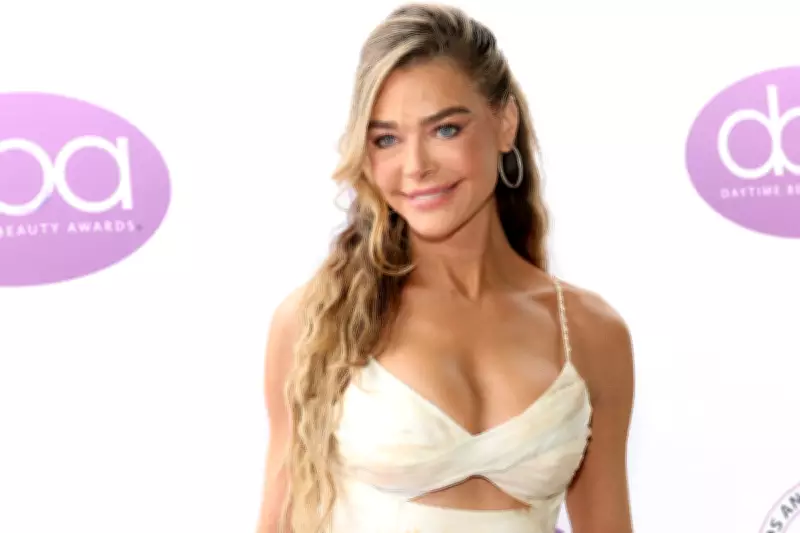 Denise Richards Shares Unfiltered Facelift Journey in Rare Hollywood Reveal