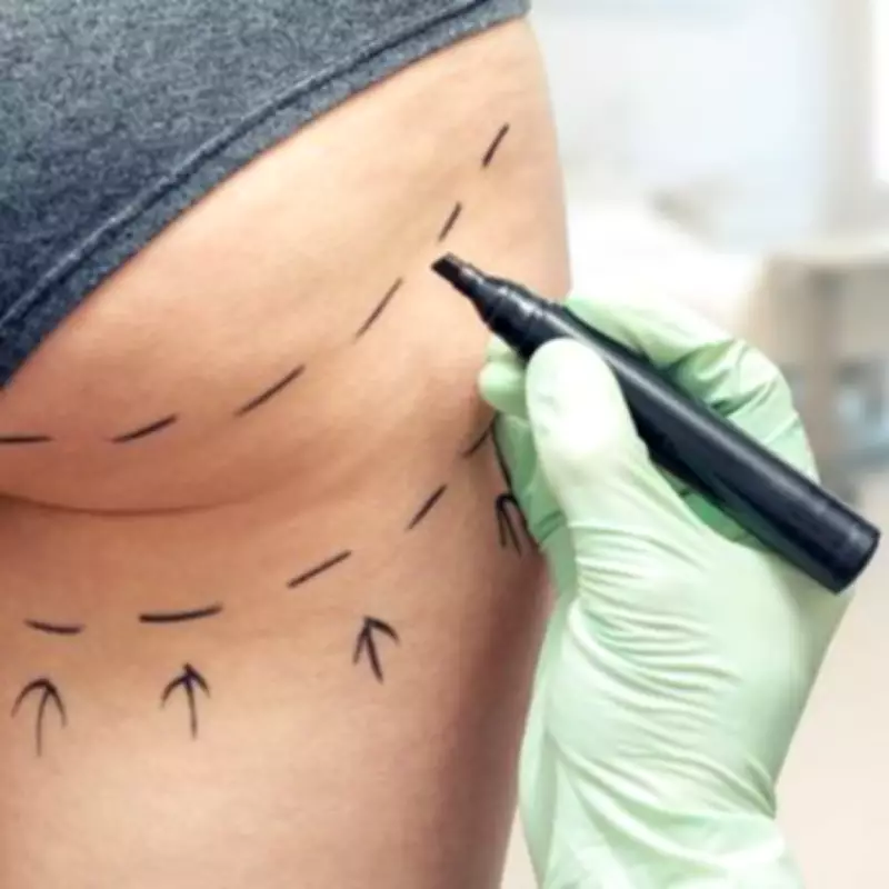 Exclusive: Nearly 500 Britons Faced Death from Liquid Brazilian Butt Lifts in Two Years