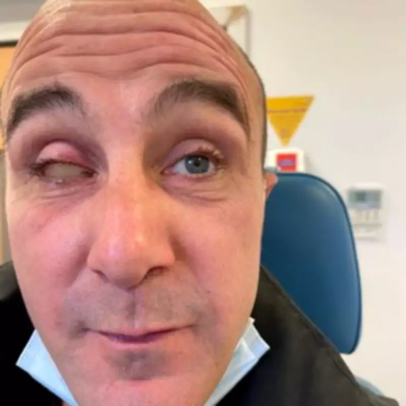 Father Loses Eye After Holiday Pool Volleyball Accident with Stranger's Nail