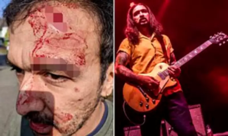 Former Zutons Guitarist Survives Racist Attack in Liverpool