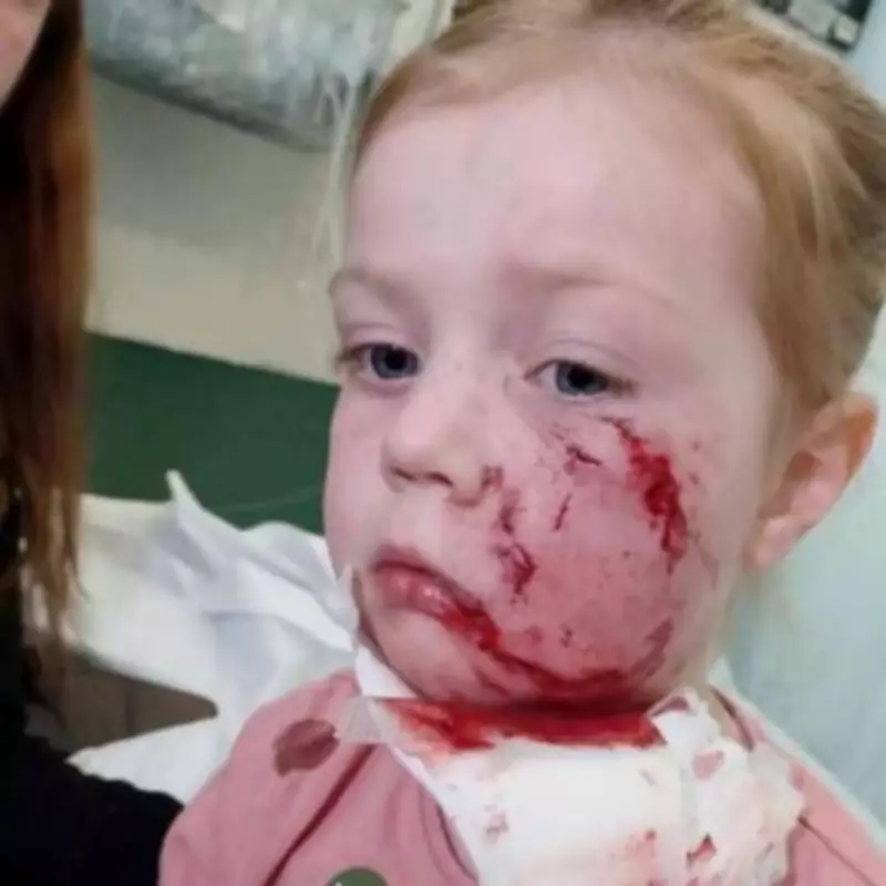 Four-Year-Old Girl's Life Changed Forever After Vicious Bulldog Attack
