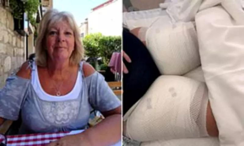 Grandmother Suffers Life-Altering Burns from Scalding Tea on Ryanair Flight