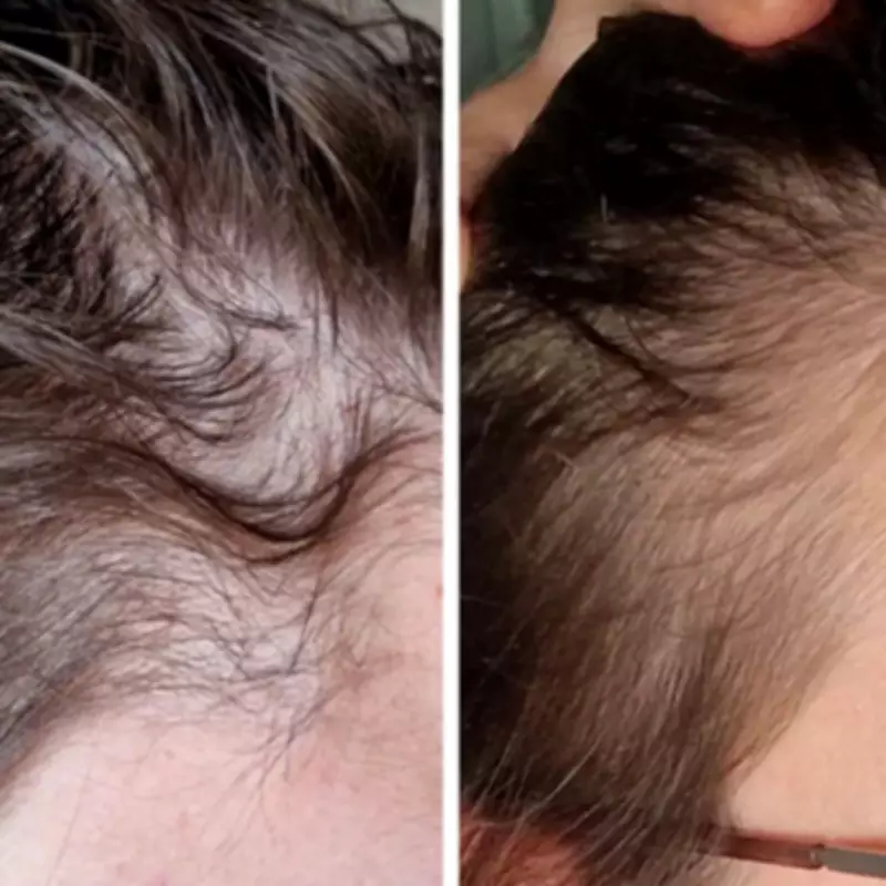 Hair 'Growing Like Crazy' with 56p-a-Day Supplement: 'My Hairdresser Noticed'
