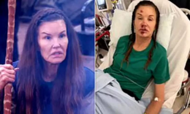I'm A Celebrity Bosses Blame Janice Dickinson for Jungle Fall in Legal Battle