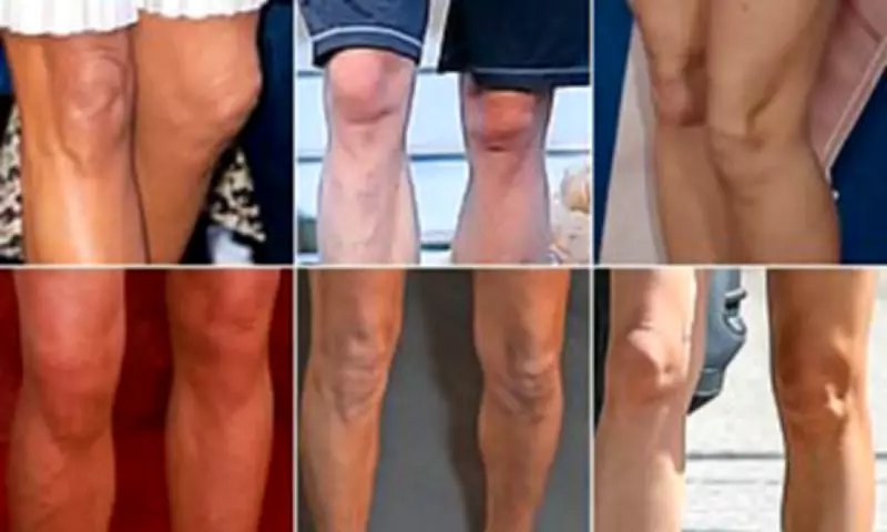 Knees Reveal True Age: Why Your Face May Not Be the First to Show Signs