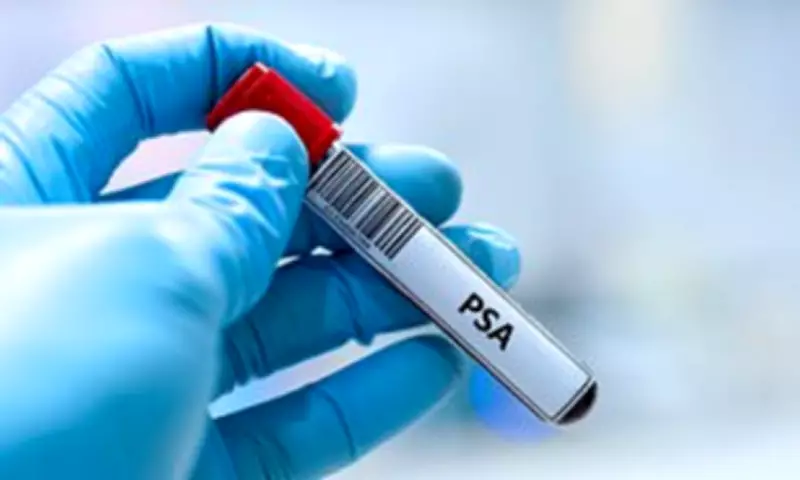 Landmark Study Urges Prostate Cancer Screening for All Middle-Aged Men