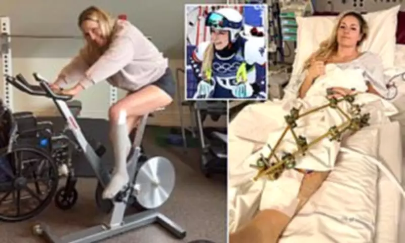 Lindsey Vonn Begins Cycling in Recovery After Nearly Losing Leg at Olympics