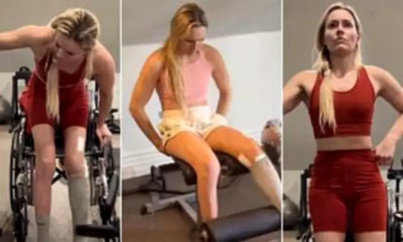 Lindsey Vonn Defies Odds: Back in Gym Weeks After Near Leg Amputation