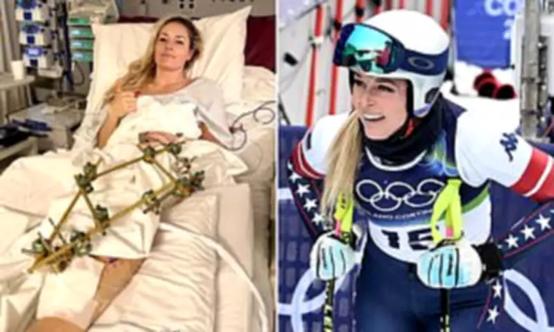 Lindsey Vonn Defies Retirement Claims After Horrific Olympic Crash