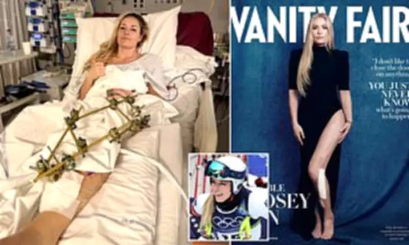 Lindsey Vonn Recounts Near-Leg Amputation After Olympic Crash Horror
