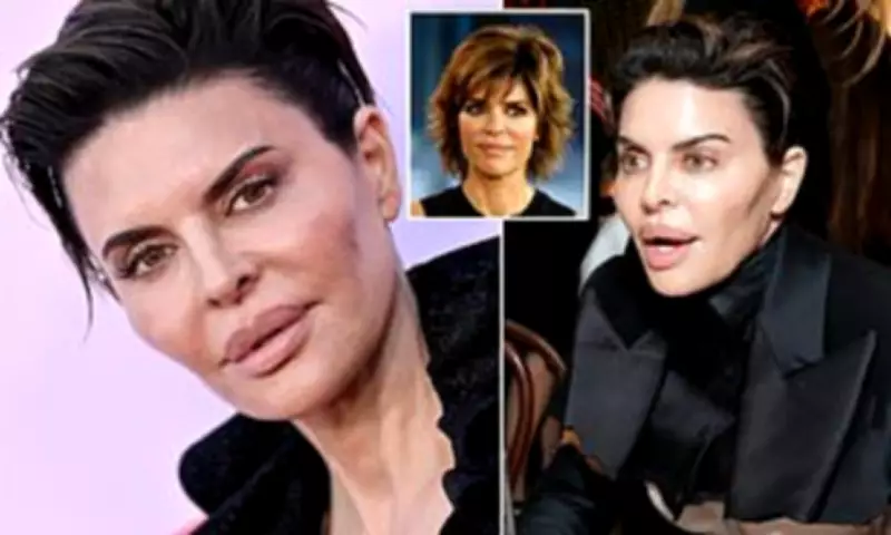 Lisa Rinna's 'Freakish' Cosmetic Nightmare: Skin Booster Left Her Cheeks Swollen