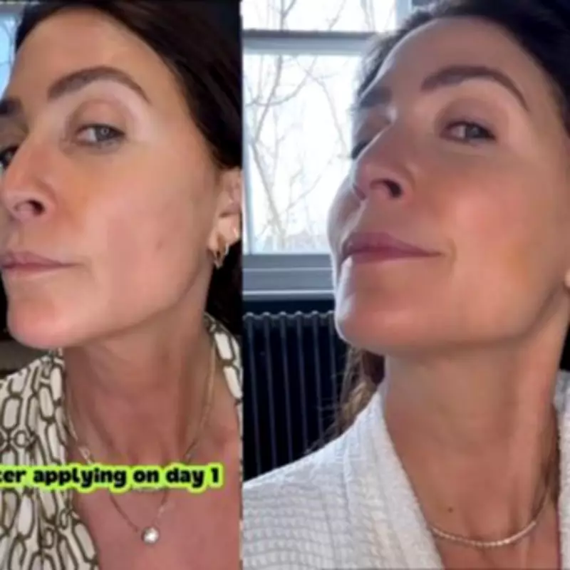 Lisa Snowdon's Neck Serum Praise: Smoother Skin in Two Weeks