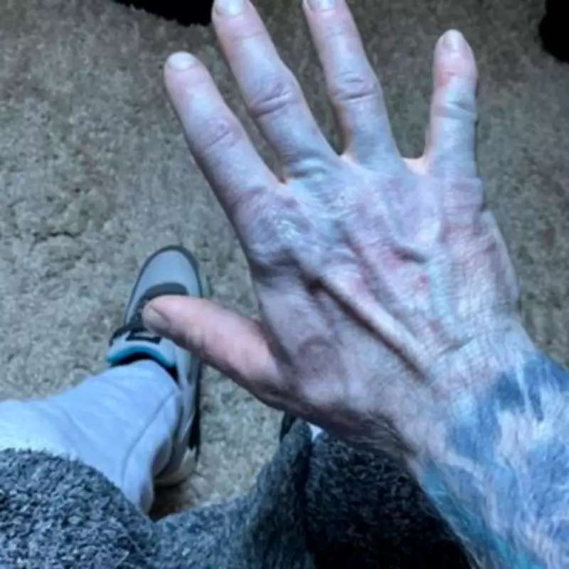 Man Rushed to Hospital After Turning Blue from Unwashed Bedsheets