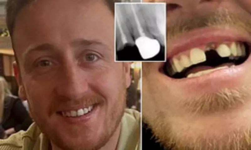 Man Wins £25,000 After Failed Veneer Treatment Forces Him to Glue Teeth