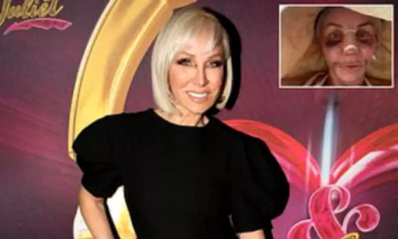 Margaret Josephs Reveals Secret Rhinoplasty and Cosmetic Surgery History