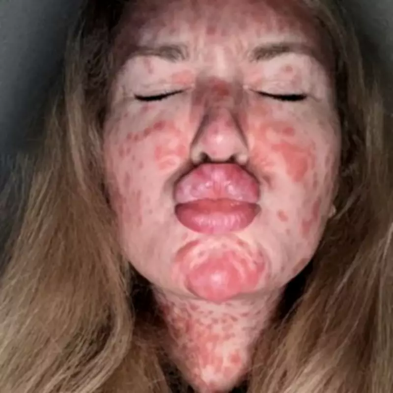 Measles Outbreak Leads to Unexpected Pregnancy After Contraceptive Patch Removal