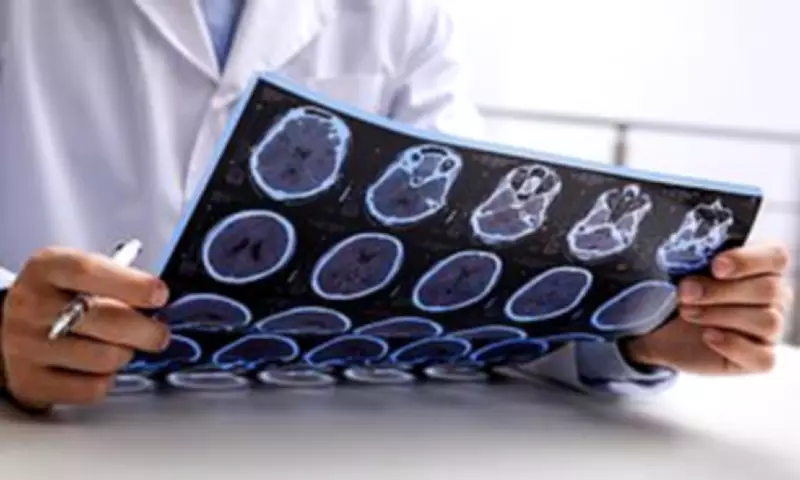 MS Cases Double in England as Study Links Smoking, Obesity and Deprivation to Higher Death Risk