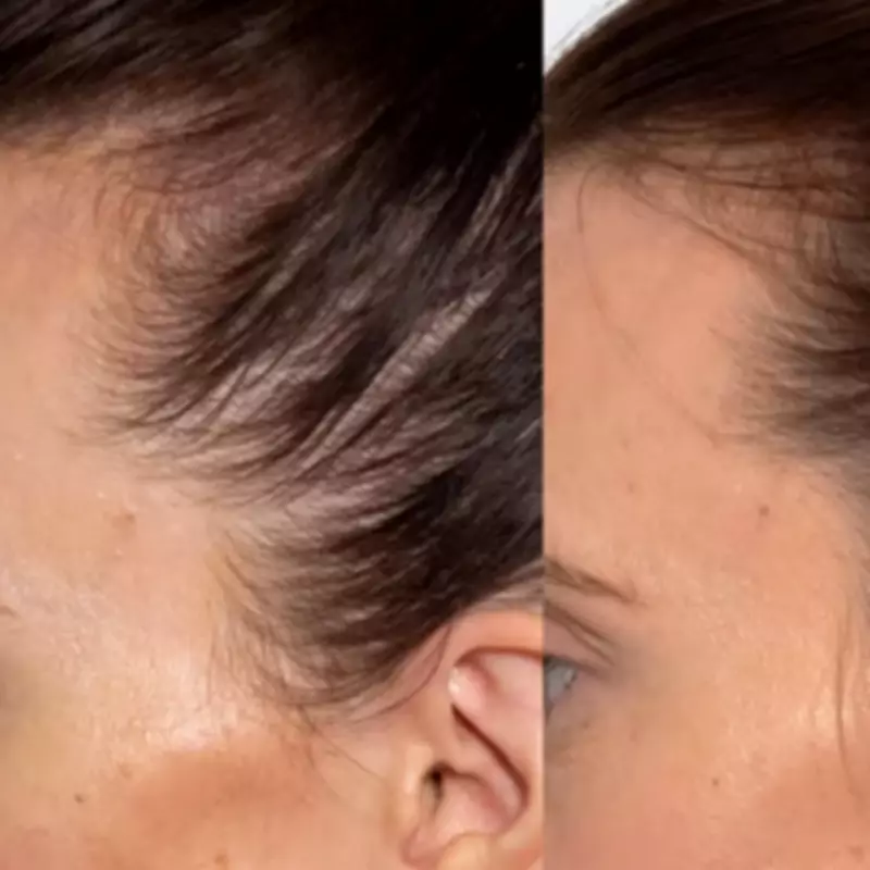 Mum's £35 Serum Boosts Post-Baby Hair Growth, Now on Mother's Day Sale