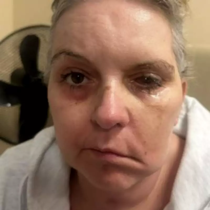 Mum's Holiday Fall Led to Coma but Revealed Life-Saving Brain Tumour