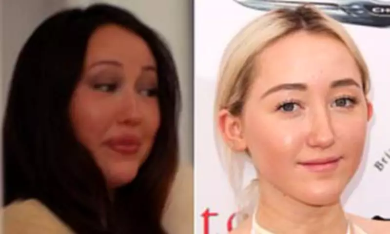 Noah Cyrus Sparks Surgery Speculation After Hannah Montana Anniversary Appearance