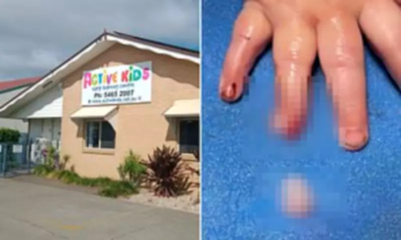 Queensland Childcare Centre Under Probe After Baby's Finger Severed