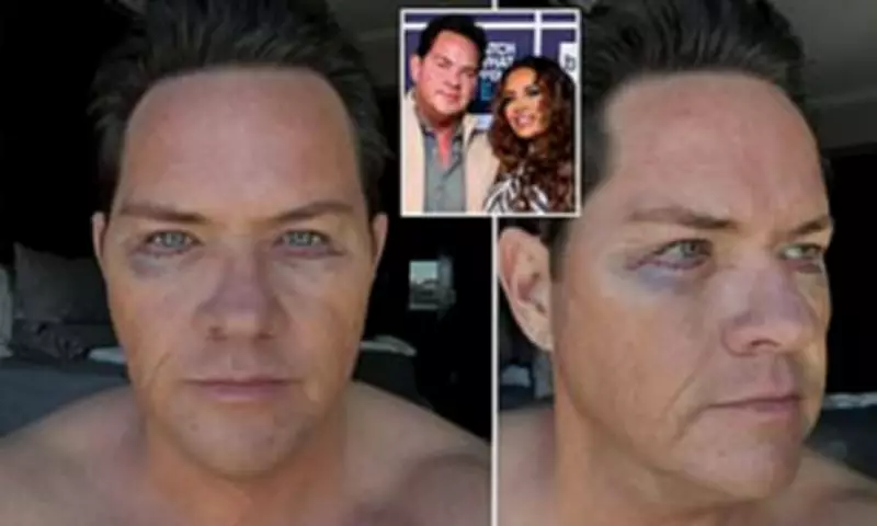 Real Housewives Star's Fiancé Reveals Plastic Surgery After Weight Loss
