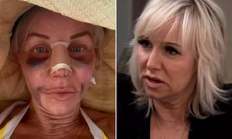 RHONJ Star Margaret Josephs Reveals Nose Job as Anti-Ageing Trend Surges