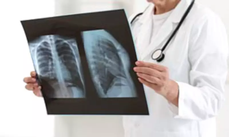 Severe Respiratory Infections Like COVID Increase Lung Cancer Risk, Study Reveals