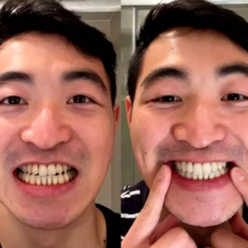 Smoker's Dentist Halts Stained Teeth Checks After 35p-a-Day Whitener Use