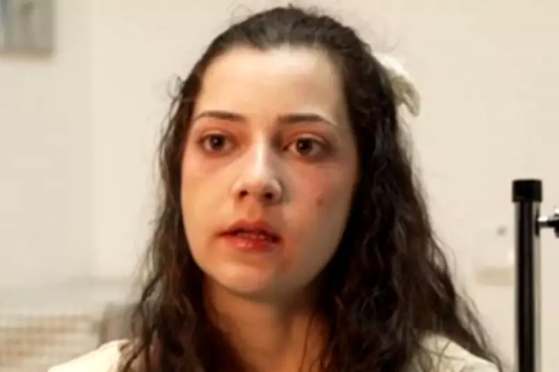 Spanish Woman Dies by Euthanasia After Winning Legal Battle Against Family Opposition