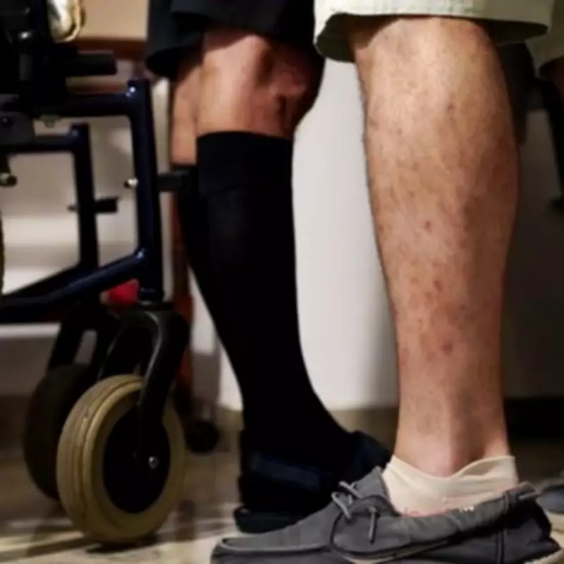 Statins Show Promise in Extending Life for Motor Neurone Disease Patients