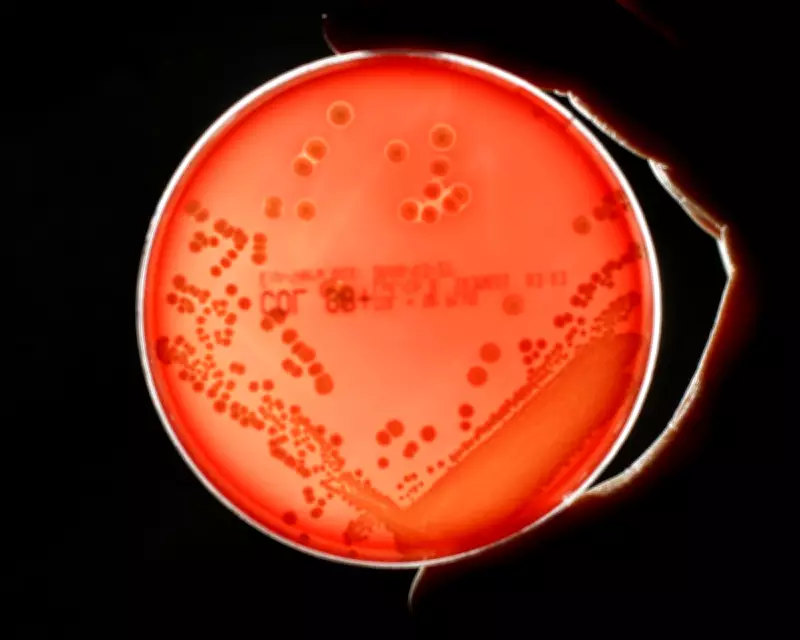 Superbug Drug Pipeline 'Worryingly Thin' as Deaths Set to Double by 2050