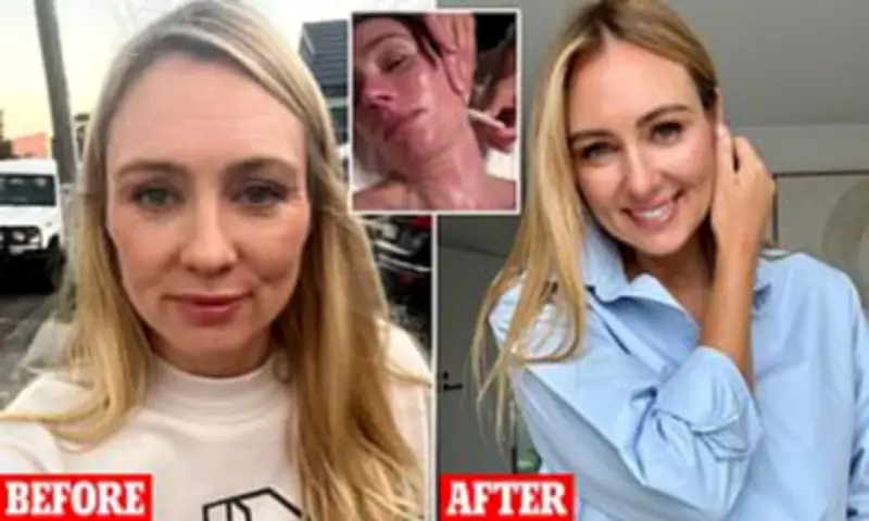 Sydney Mum's Honest Cosmetic Journey: Treatments That Worked and One She Regrets
