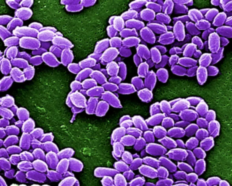 Taxonomy's Vital Role: From Anthrax to Antarctic Soils
