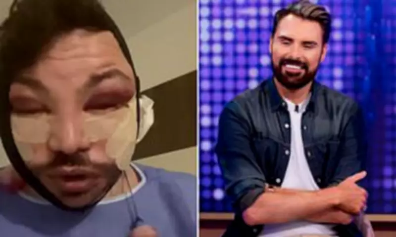 The Rise of 'Brotox': Men Embrace Cosmetic Tweakments as Taboos Fade