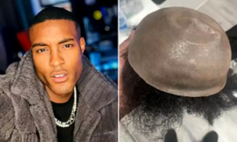 Tinder's 'Most Right-Swiped Man' Reveals 14-Year Wig Secret Before £5k Hair Transplant