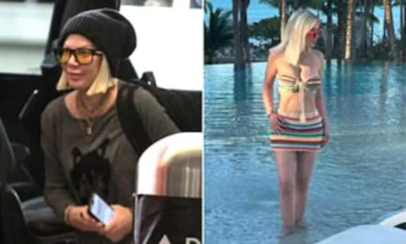 Tori Spelling Hits Back at Plastic Surgery Critics and Reveals Health Condition