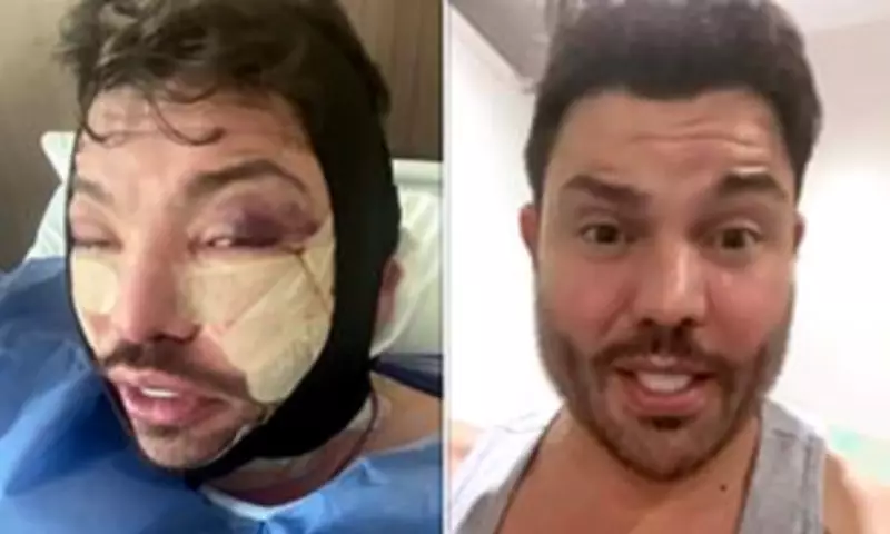 TOWIE's Bobby Norris Shares Painful Recovery After Face and Neck Lift Surgery