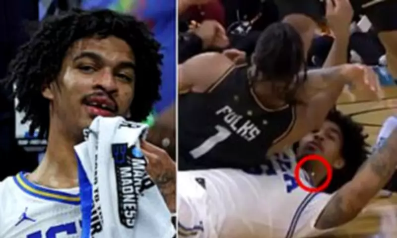 UCLA's Skyy Clark Loses Tooth in Gruesome March Madness Injury