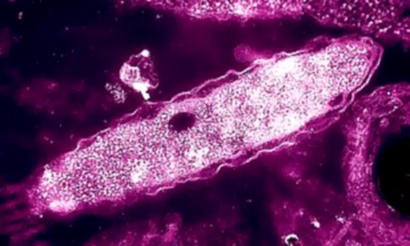 UKHSA Investigates Legionnaires' Disease Cluster in London Amid Rising Cases