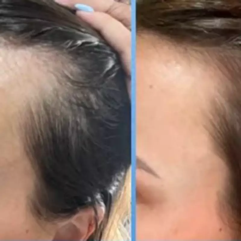 UKLash Hair Growth Serum Delivers 'Life-Changing' Results with 20% Discount