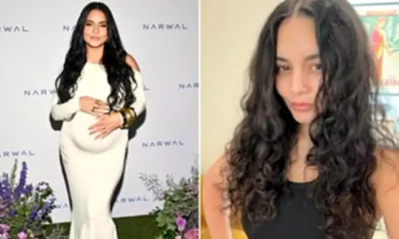 Vanessa Hudgens Reveals Postpartum Hair Loss Struggle After Second Child