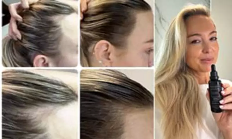 Vita-Growth Scalp Serum Returns to Australian Shelves After Sell-Outs