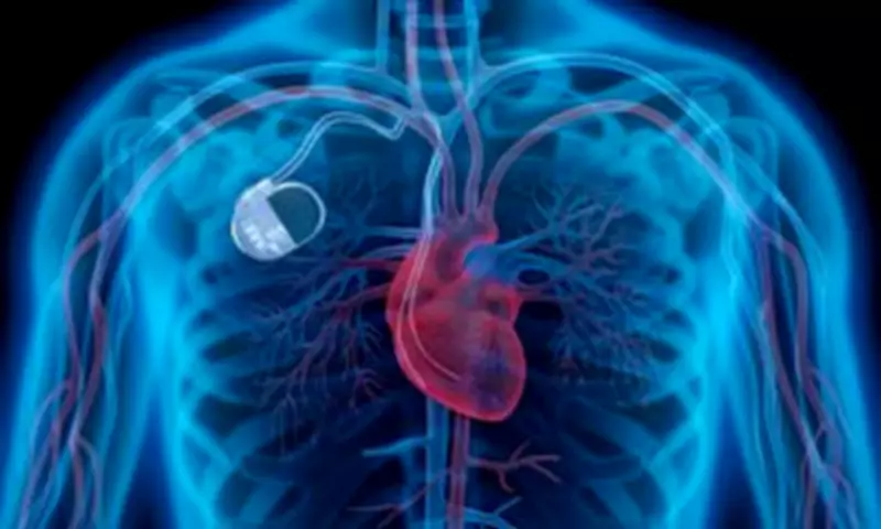 Watch-Sized Heart Implant Zaps Organ to Switch Fuel Source, Boosting Function
