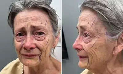 70-Year-Old's Facelift Transformation Stuns Millions on TikTok