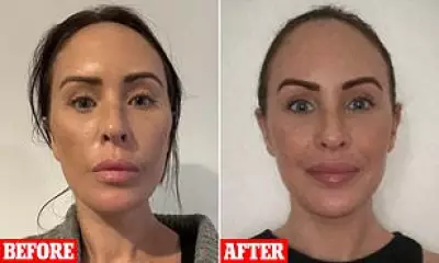 Australian Woman Defends £10k Turkish Facelift Amid Trolls' Ageing Claims