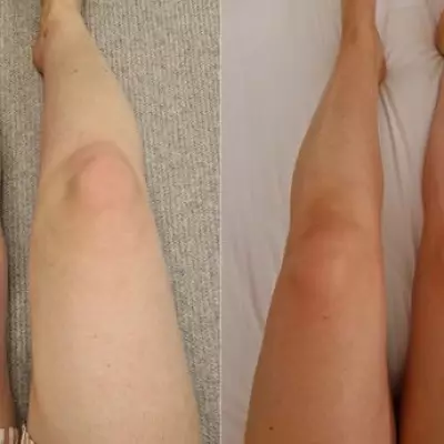Bride Discovers 'Most Realistic' Transfer-Free Tanning Gel for Wedding Day